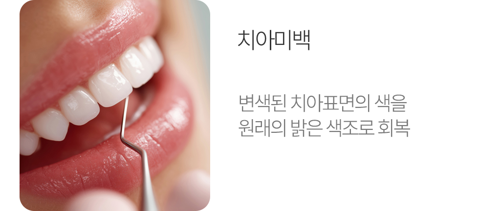 치아미백