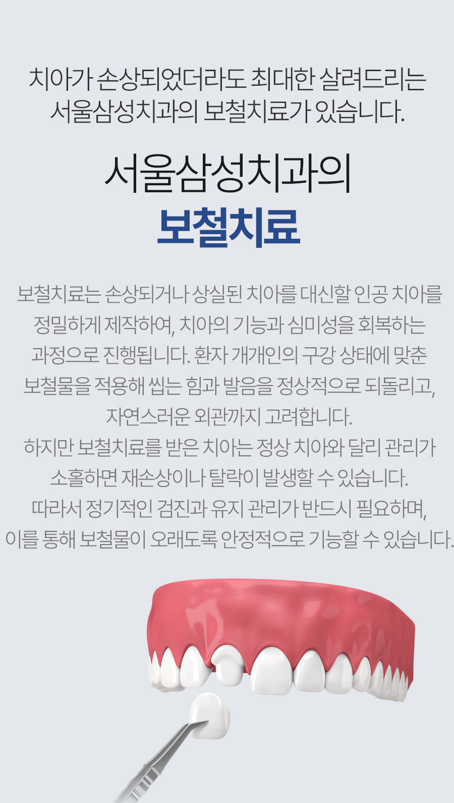 서울삼성치과 보철치료 안내
