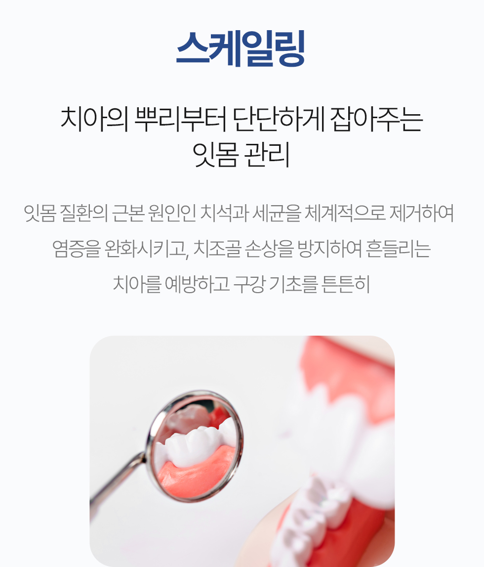 스케일링
