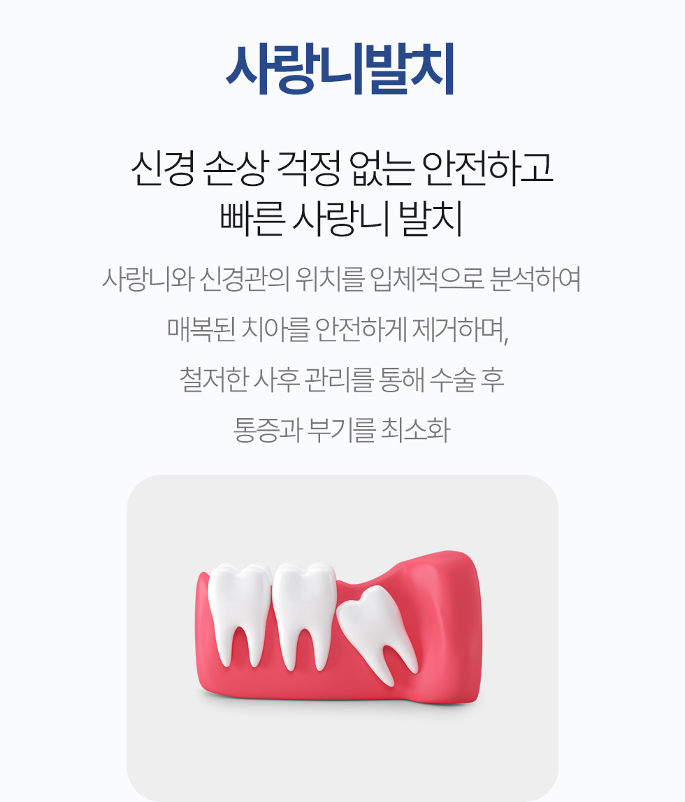 사랑니발치