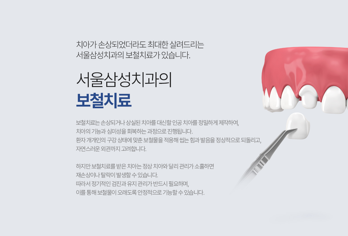 서울삼성치과 보철치료 안내